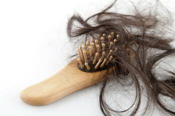 Alopecie aneb vypadávání vlasů netrápí jen muže