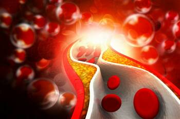 Cholesterol k našemu životu patří. Má však dvě tváře: hodnou a zlou.