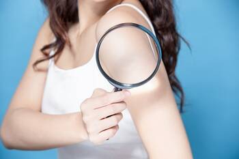 Zdraví pod lupou: Změny na kůži - riziko rakoviny kůže