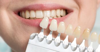 Domácí bělení zubů - šetrné, snadné a se surovinami, které máte doma