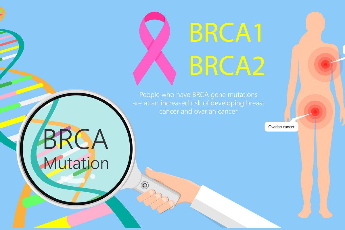 Does prostate cancer kill more than breast cancer Does prostate cancer kill more than breast cancer